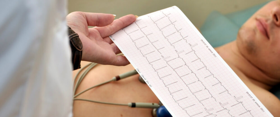 Por que fazer um check-up cardiológico?